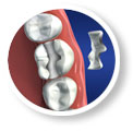 Advanced Treatments at Gearhart Dentistry